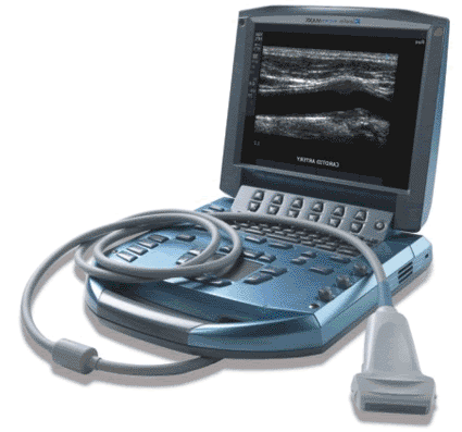 Image: The MicroMaxx point-of-care ultrasound system (Photo courtesy SonoSite).